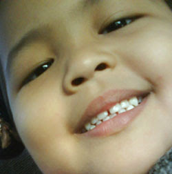 four years old teeth gum
