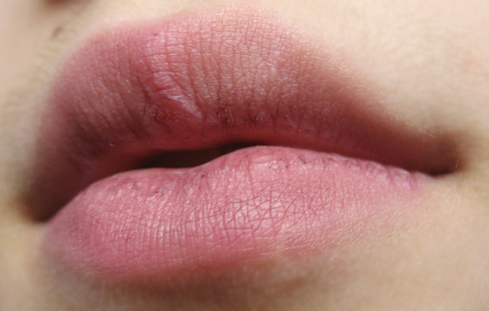 [Lips+(4).jpg]