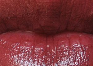 [Lip+II.jpg]