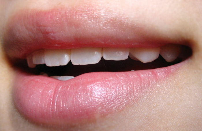 [Post+-+lots+(2).jpg]