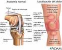 [rodilla.jpg]