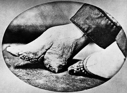 chinese foot binding tradition