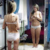 Las consecuencias físicas de la bulimia