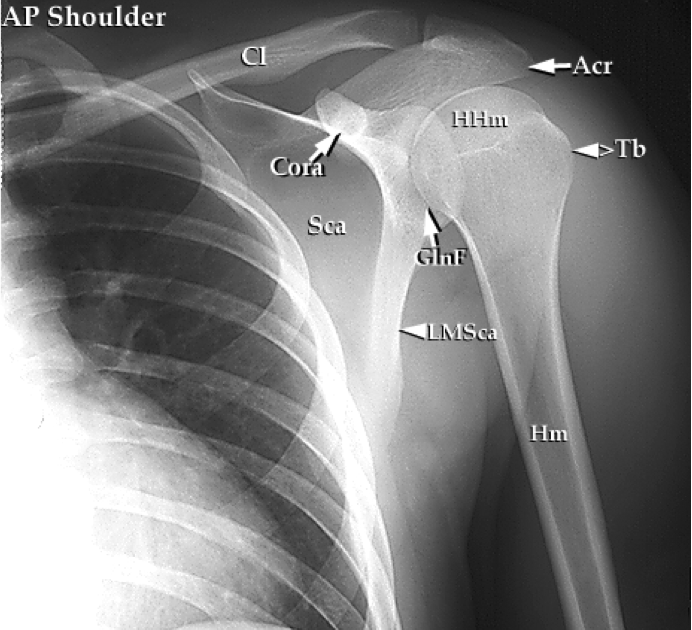 Physio Questions Introduction to the Shoulder Complex (Part I) What structures are involved