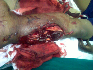 Gory+Pictures+of+Accident+Victims victims in the guess that they would be justify gory accident victim ...
