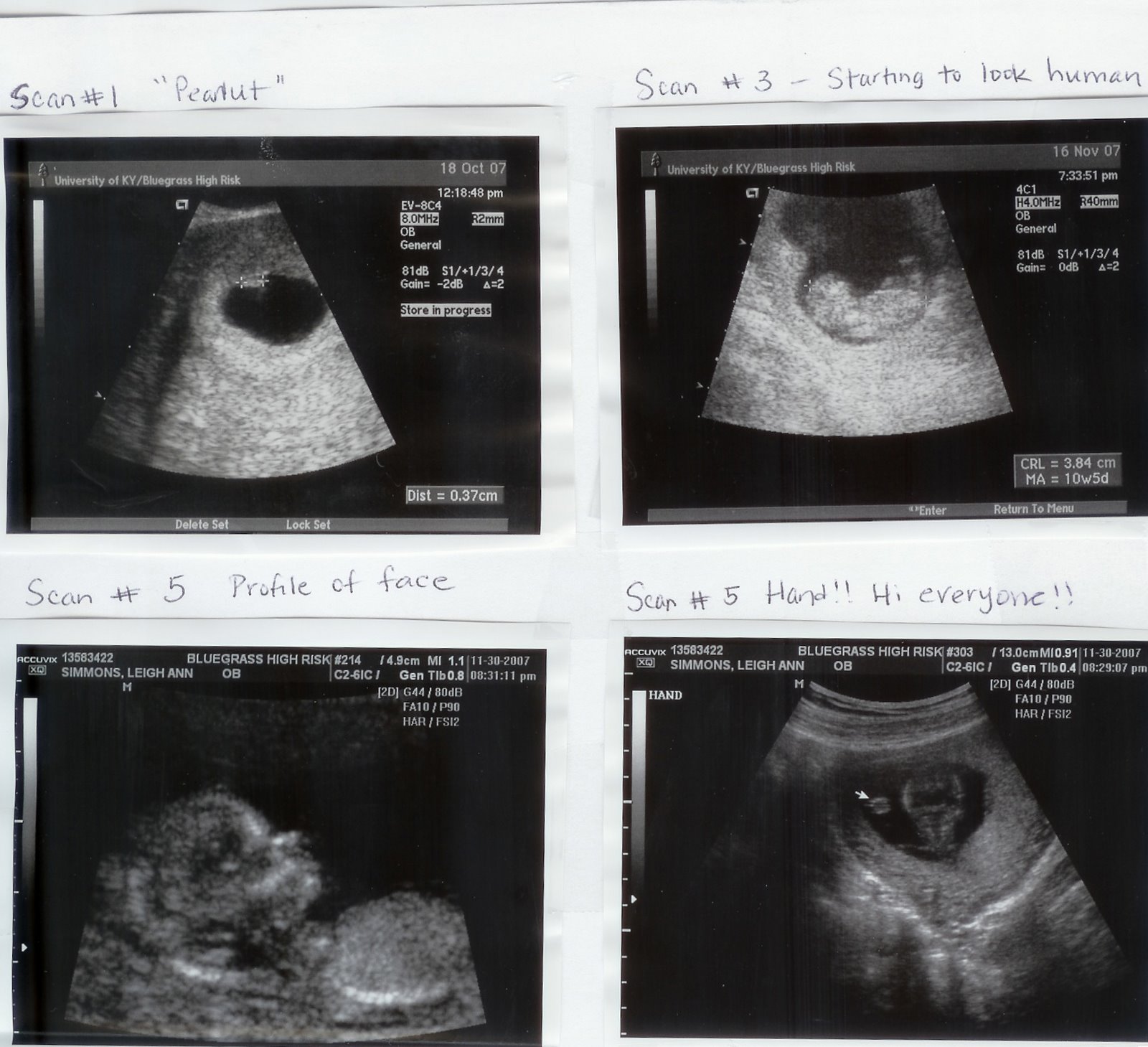 Baby Scans