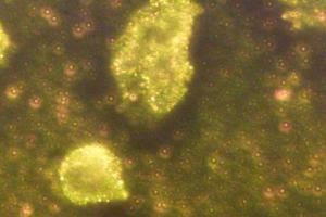 Gold Nanoparticles