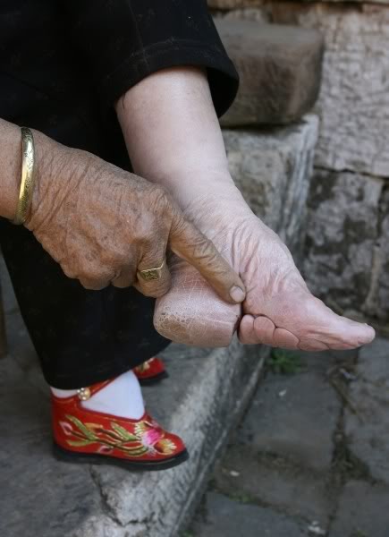 [foot+binding.jpg]
