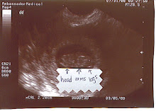 Our 2nd ultrasound