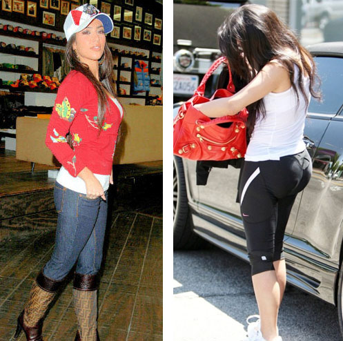 Nicki Minaj  Plastic Surgery on Nicki Minaj Before And After Plastic Surgery Pics  Nicki Minaj Before