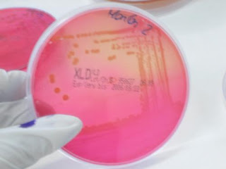 Los baños medicinales a atopicheskom la dermatitis