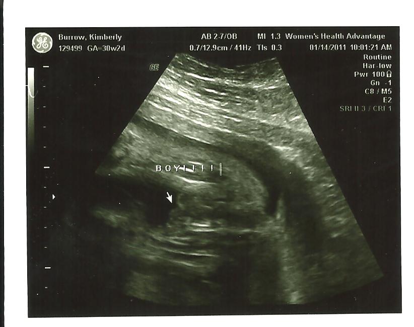 Trimester baby third ultrasound jerry hey preparing whatcha doin lookin down there Preparing For Baby Jerry: Third Trimester Ultrasound