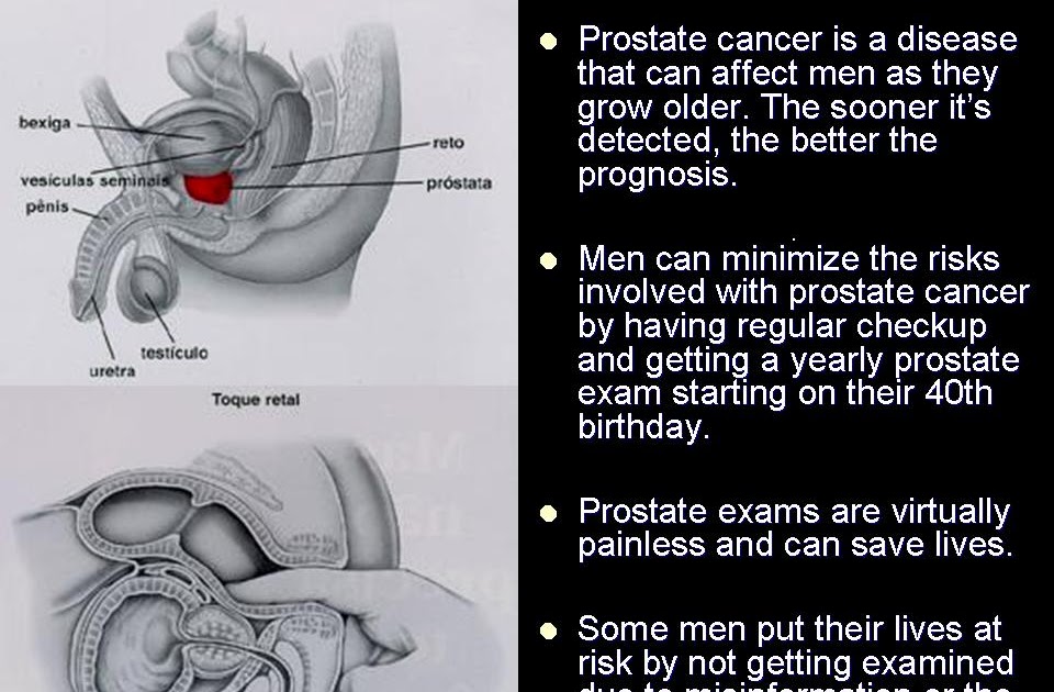 Something2Share Prostate Check & 7 Prostate Symptoms