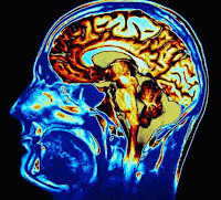 What is health and diseases brain damage