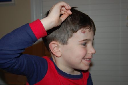 [Ethan+Laceration.JPG]