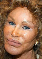 Khir+toyo+botox