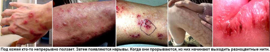 Такое ощущение что под кожей кто-то ползает Такое ощущение что под кожей кто-то ползает