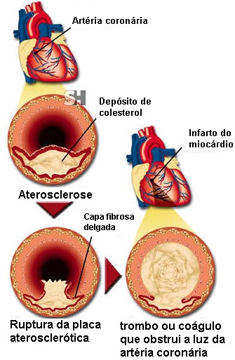 http://4.bp.blogspot.com/_xzllOHT4oBI/S6w03I5FPVI/AAAAAAAAAuk/ngolIu_5ciU/s1600/873166033_f2afb83d05_m.jpg