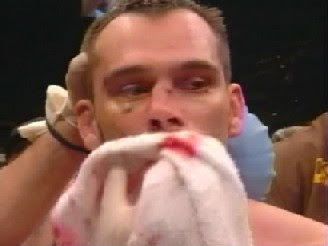 Rich Franklin Nose