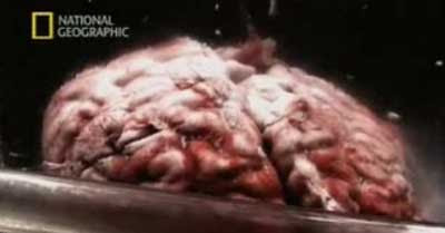 Sampel Jaringan Otak Einstein …