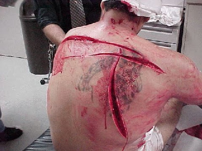 Horrible Wounds