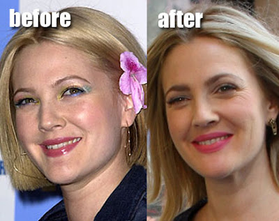 Awful Plastic Surgery. via awful plastic surgery. Awful Plastic Surgery. via