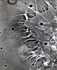 the hela cell line and the cervical cancer case of henrietta lacks In an excerpt from her book, the immortal life of henrietta lacks, they became the first immortal human cell line ever grown in culture and one of the most important tools in medicine: research on hela was vital to the development of the polio hopkins, telinde had developed a theory about cervical cancer that. the hela cell line and the cervical cancer case of henrietta lacks In an excerpt from her book, the immortal life of henrietta lacks, they became the first immortal human cell line ever grown in culture and one of the most important tools in medicine: research on hela was vital to the development of the polio hopkins, telinde had developed a theory about cervical cancer that.