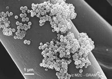 Estafilococo+Dorado+Tratamiento ... IMANES: TRATAMIENTO DE ESTAFILOCOCO DORADO (AUREUS) CON BIOMAGNETISMO