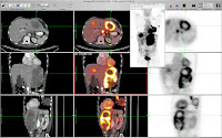 OsiriX is an image processing