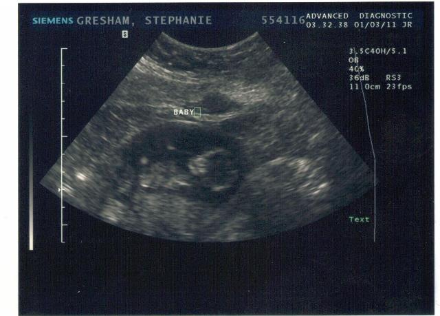 what-to-expect-at-8-week-dating-scan-amateur-wife-interacial