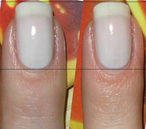 Loo Do You Want Longer Nail Beds Do You Want Longer Nail Beds