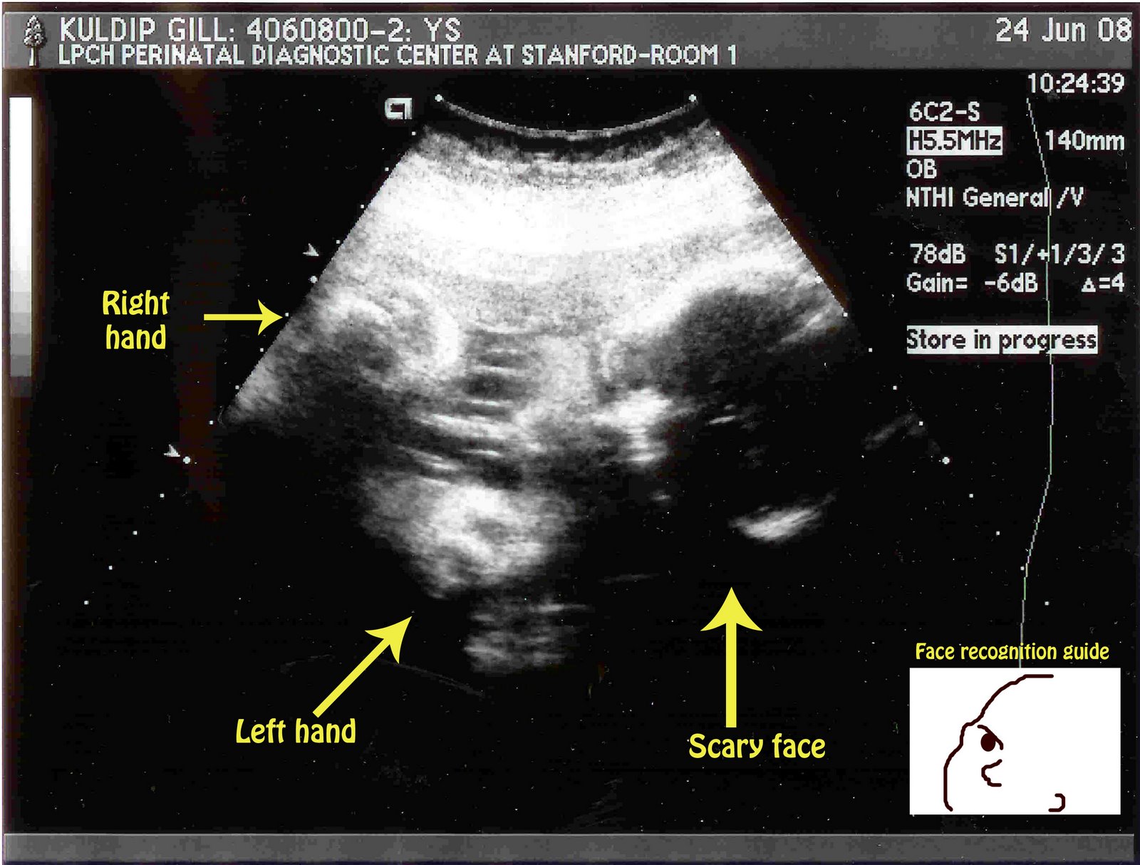 [Harry's+final+ultrasound.jpg]
