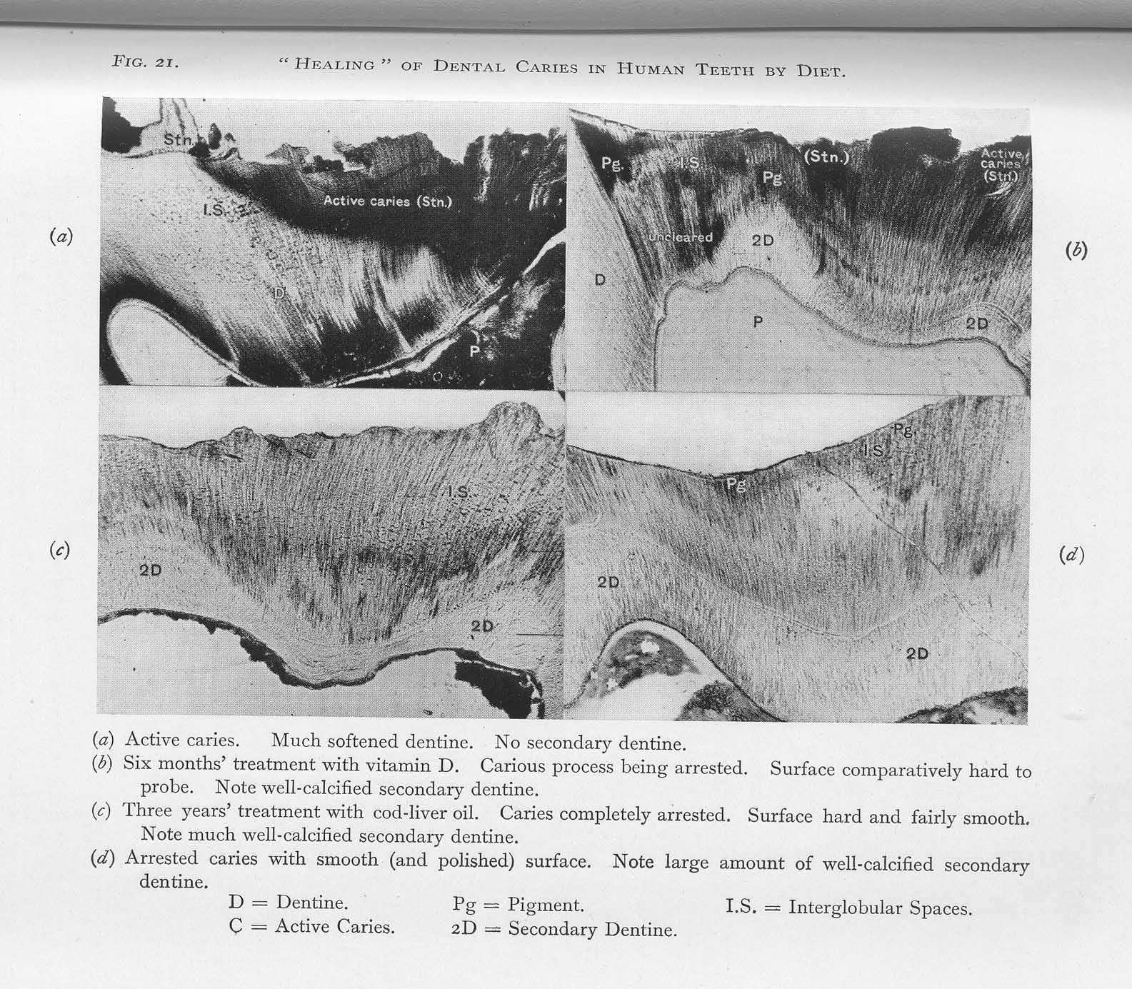 [cavities+healing.jpg]
