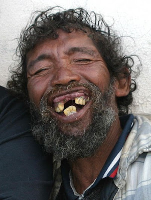 girls with rotten teeth girls with rotten teeth