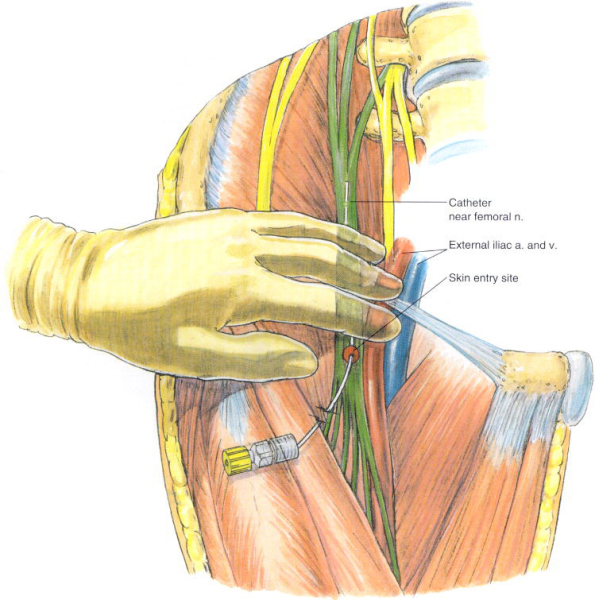 femoral nerve anatomy