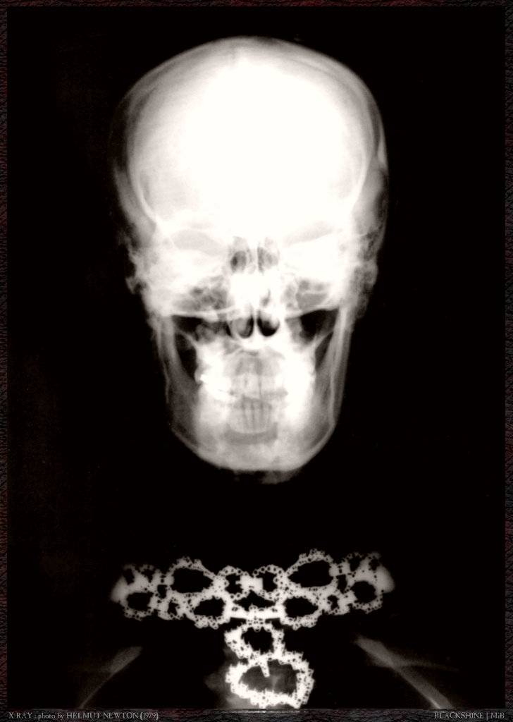 [blk-hnw072-x-ray-head.jpg]
