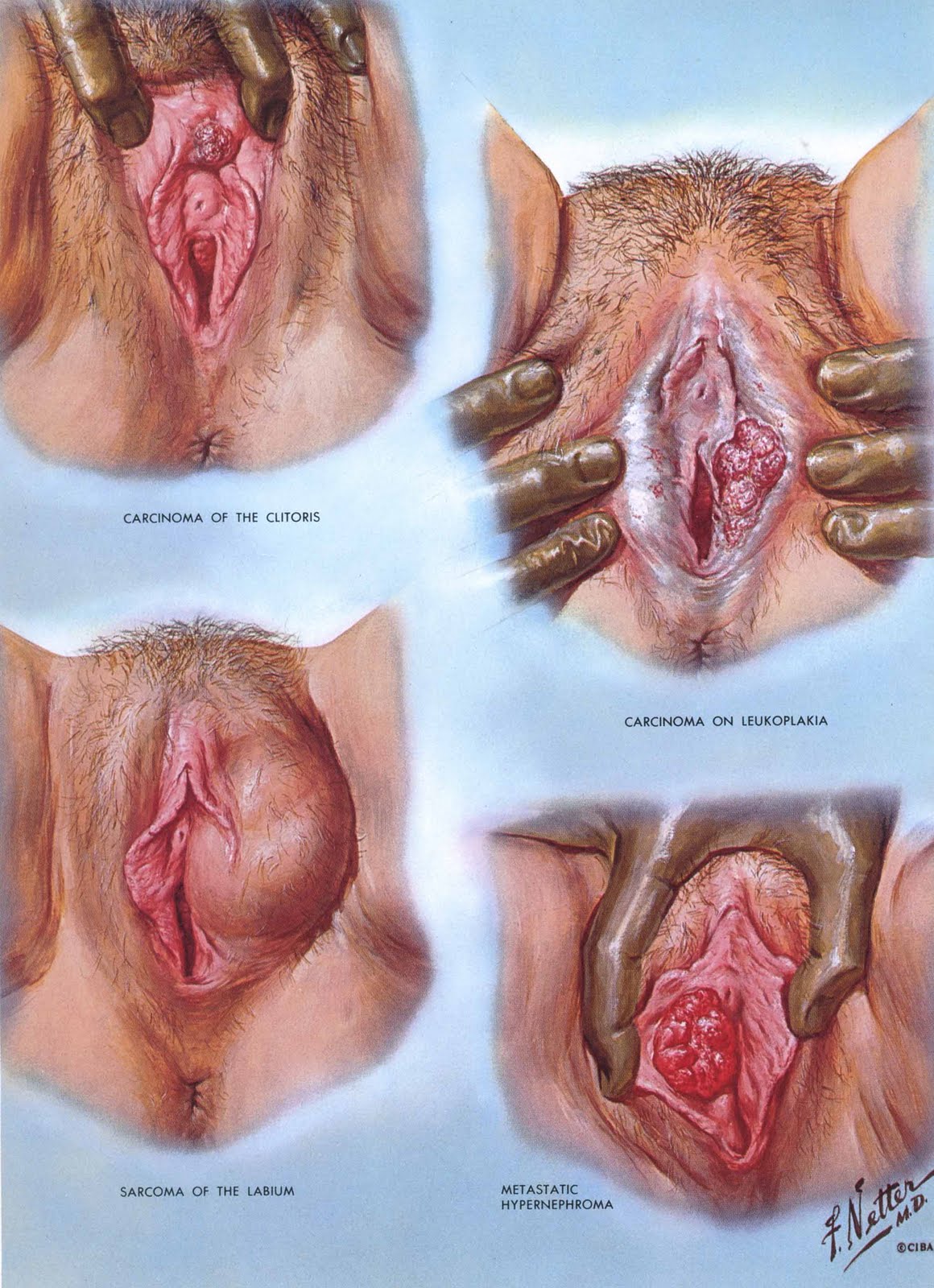 Anatomy Netter