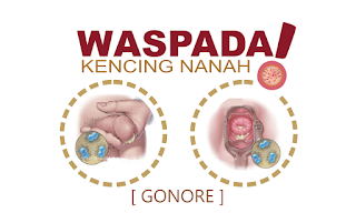 Image Penyakit kencing nanah atau infeksi saluran kemih