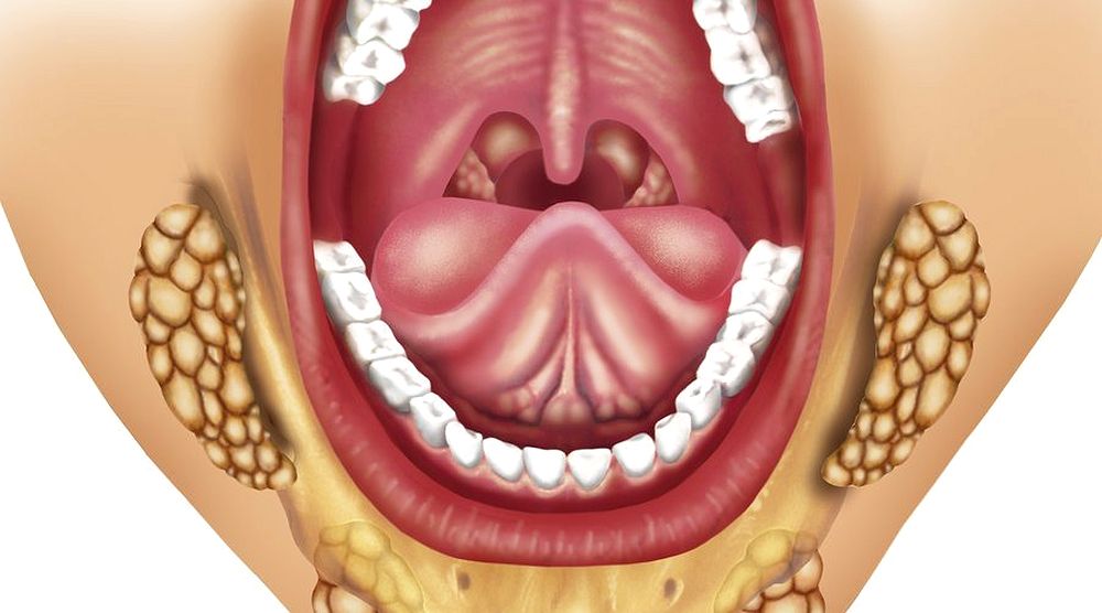bulto debajo de la mandibula bulto debajo de la mandibula