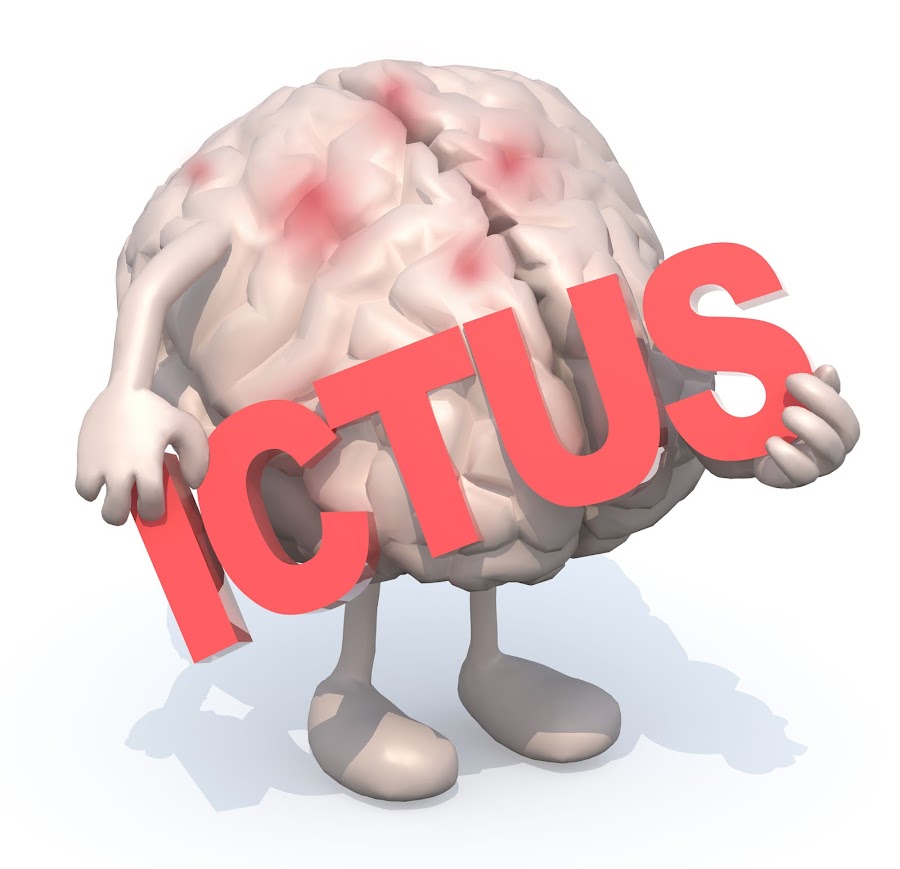 ictus cerebral actuar deprisa