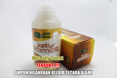 Cara Menghilangkan Keloid Di Wajah Cara Menghilangkan Keloid Di Wajah