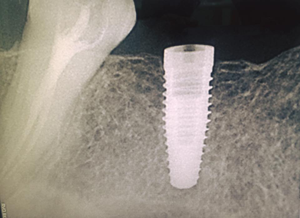 ODONTOS ACADEMY FOR CLINICAL DENTAL STUDIES Implantology Council of