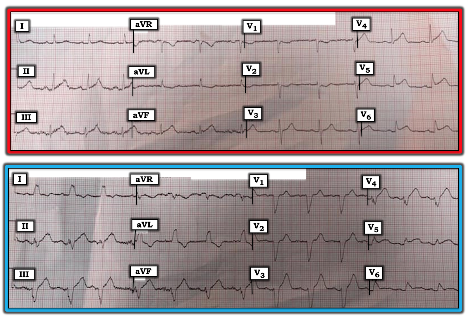 The Ecg rhythm strip examples figure 29 Ecg rhythm strip examples figure 29 right! think