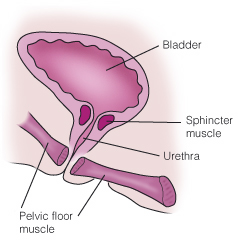 symptoms diagnosis Poor anal sphincter muscle