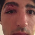 Coppia gay brutalmente aggredita a Parigi