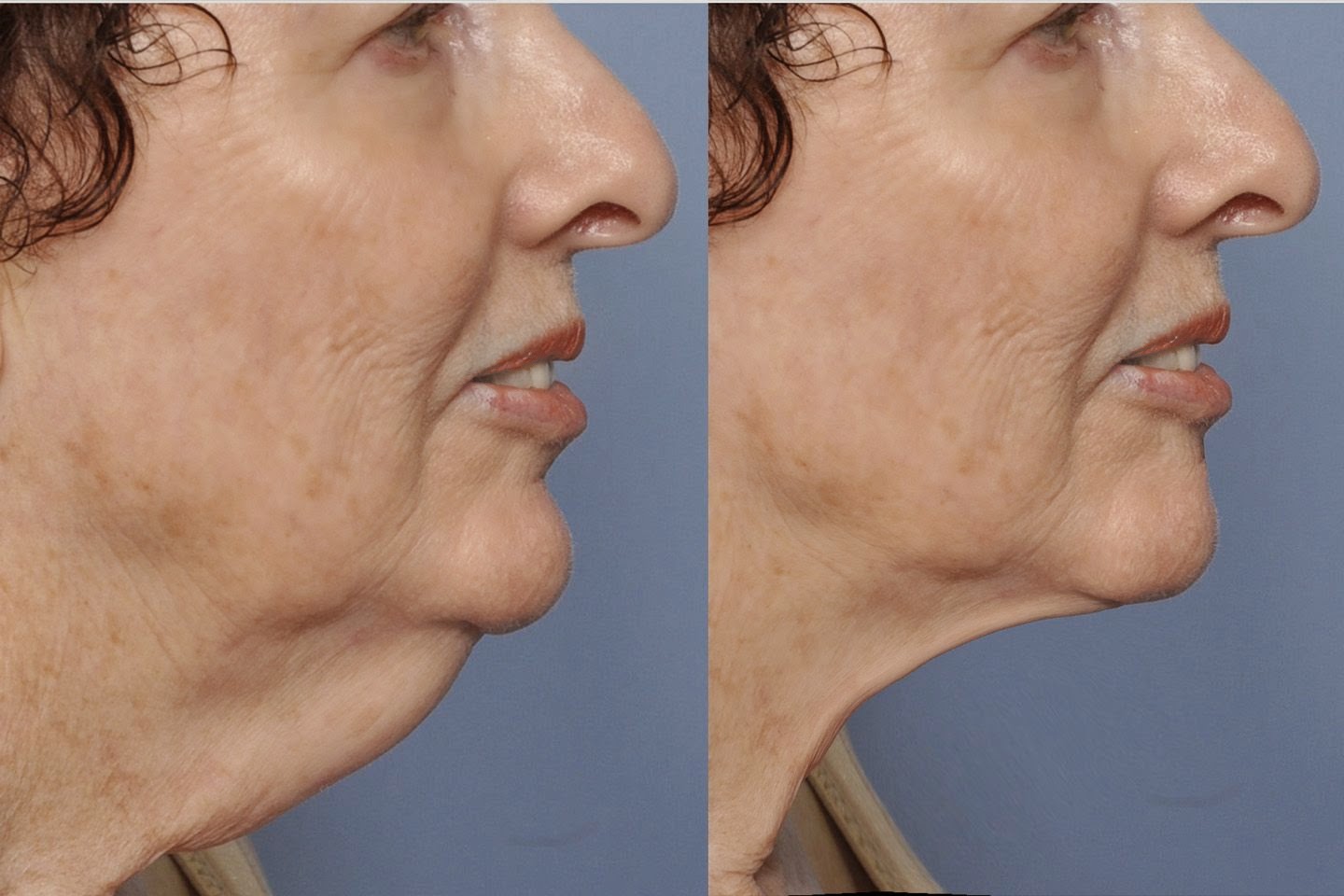 facial-exercises-to-look-younger-reduce-and-tone-a-double-chin-by