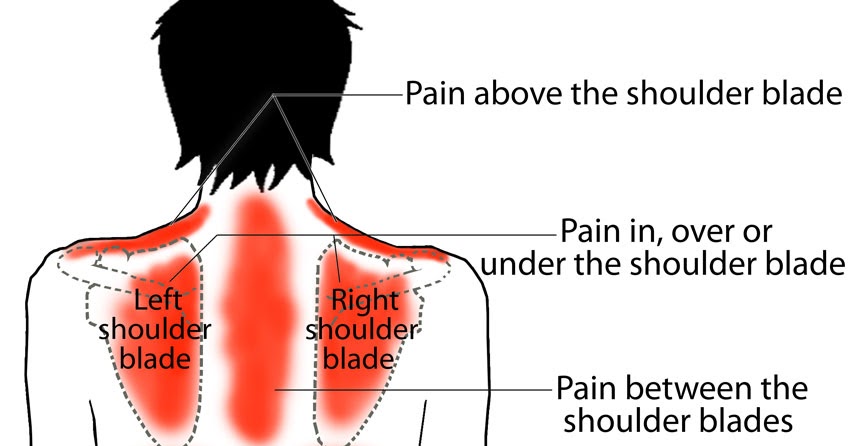 при пневмонии болит спина. левое плечо. боль в спине. где болит при пневмонии.