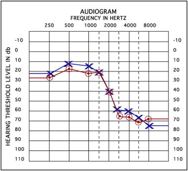 Cara Pemilihan Alat Bantu Dengar Sebelum Membeli Alat Bantu Dengar Murah