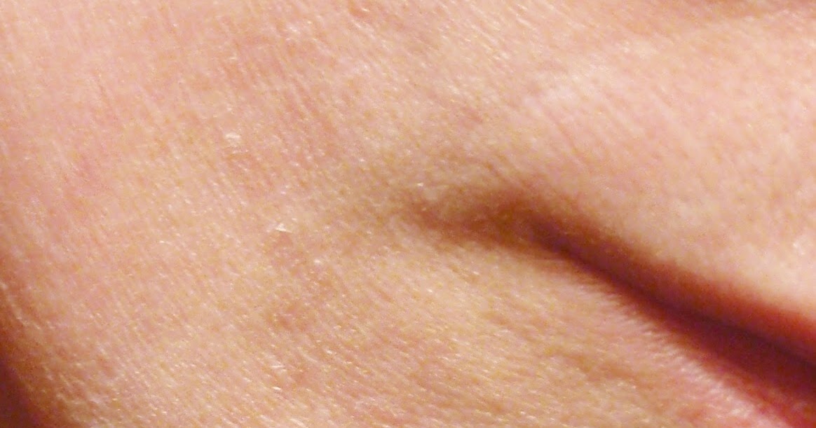 The Juicy Beauty Word Over Exfoliated Dehydrated Skin