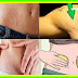 Simple Natural Remedies To Get Rid Of Stretch Marks!